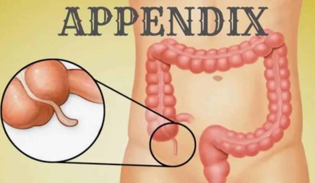 Apandisit nedir? Apandisit gereksiz bir organ mı? 13